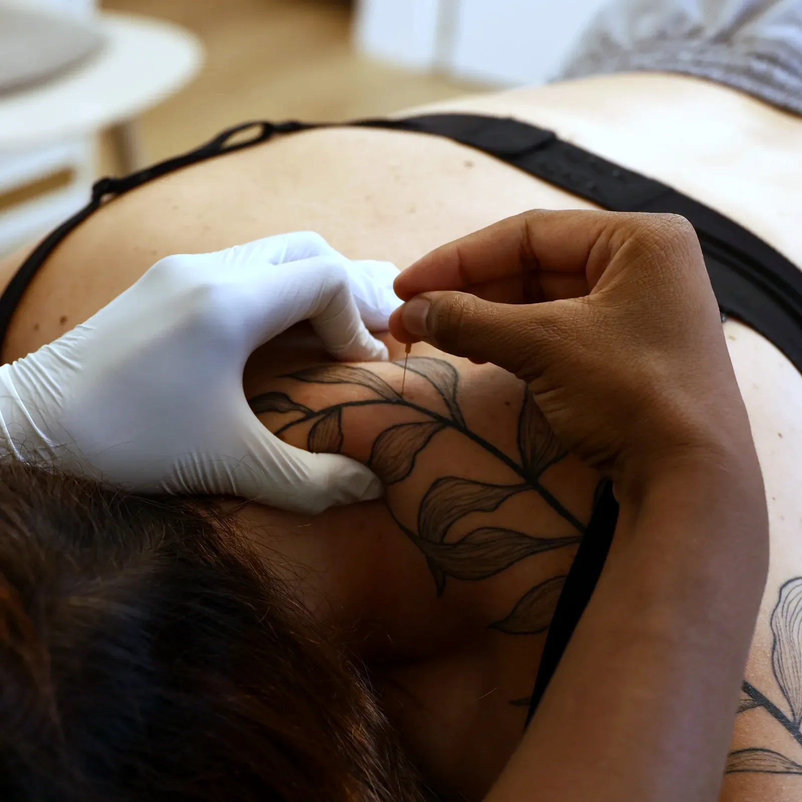 Dry Needling bei Therakura — Behandlungssituation